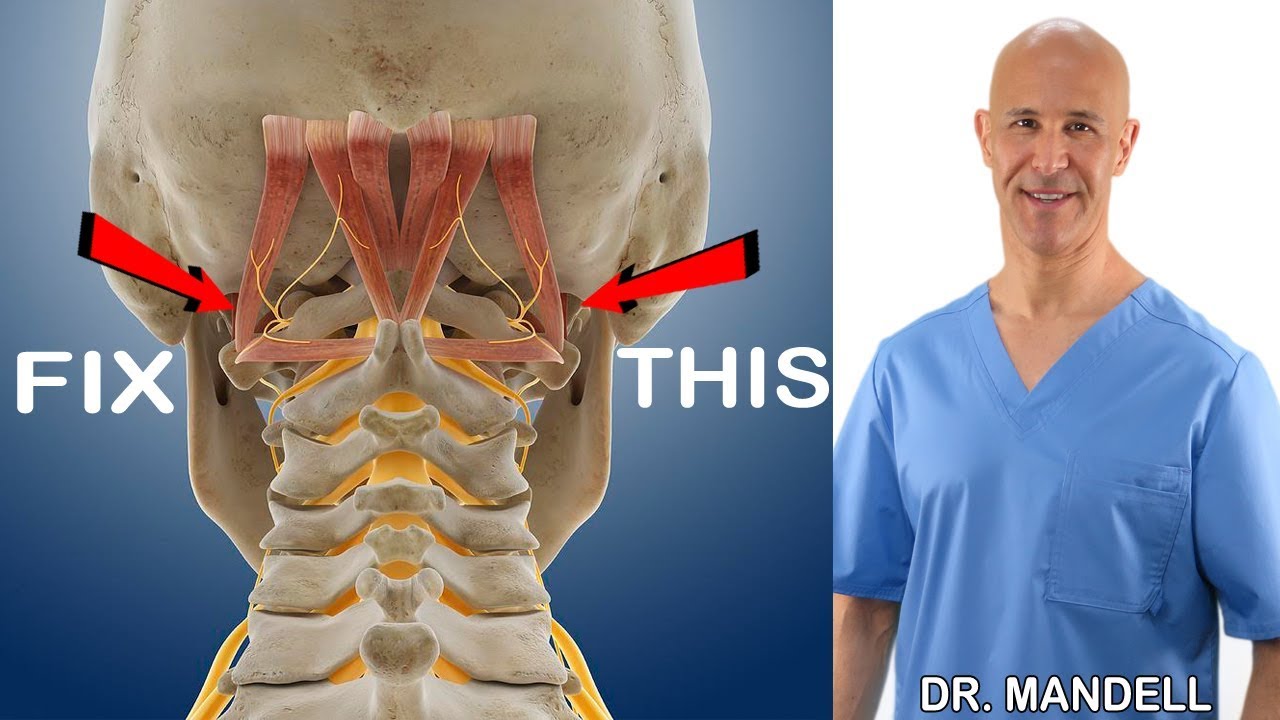 Stiff trigger stiffness causes integrativeworks muscles patterns integrative exercises works neuromuscular